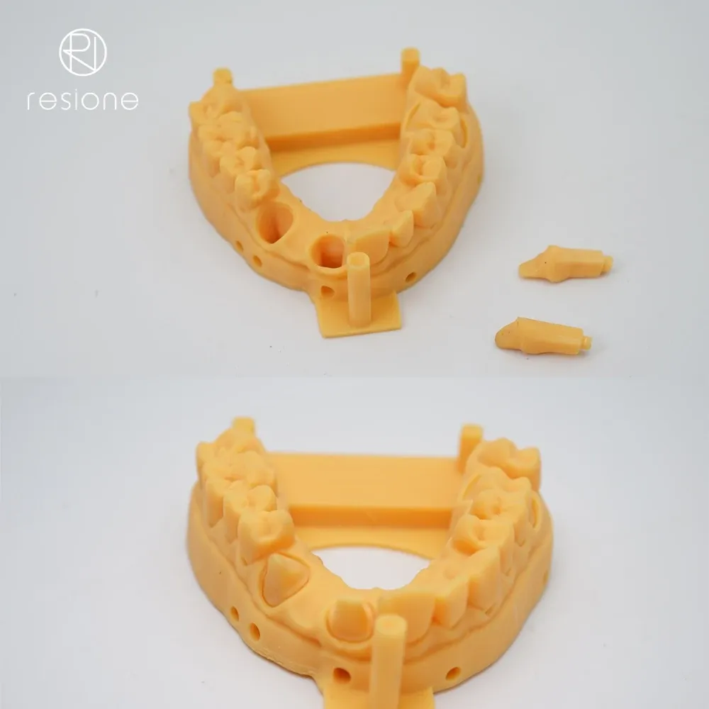 Dental-Gießharz 405nm 1kg für Dentalmodelle