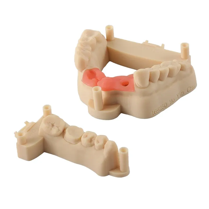 Elastisches Dental-Gießharz 405nm 1kg für Dentalmodelle