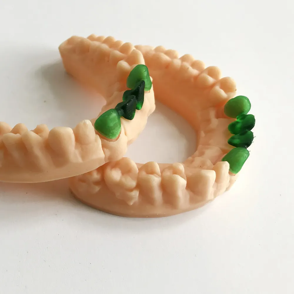 Harz Dental Casting 405nm UV Photopolymer für 3D Drucker